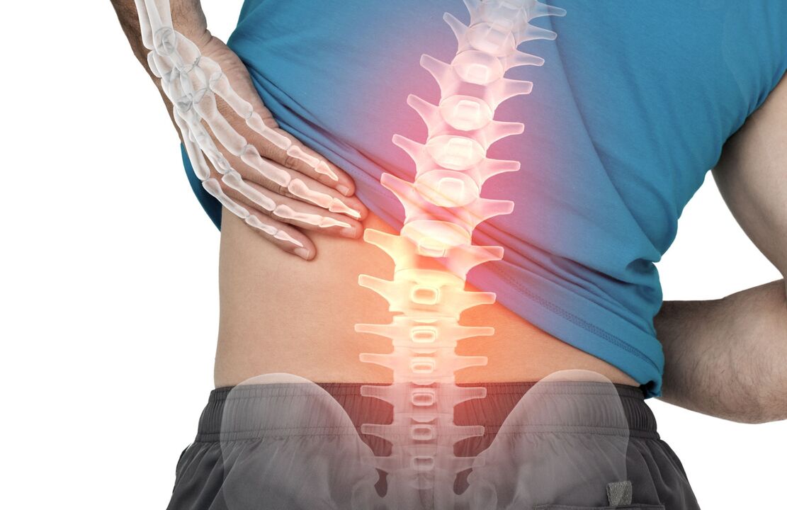O perigo de ostecondrose do lumbar