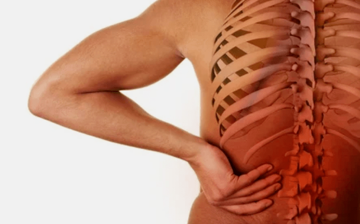 As causas da osteocondrose do lumbar