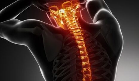 Osteocondrose de toda a columna vertebral