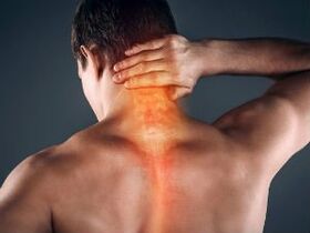 Os primeiros signos e síntomas da osteocondrose cervical
